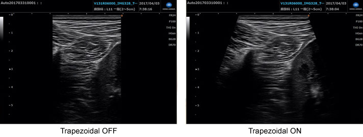 Sonimage MX1 Platinum